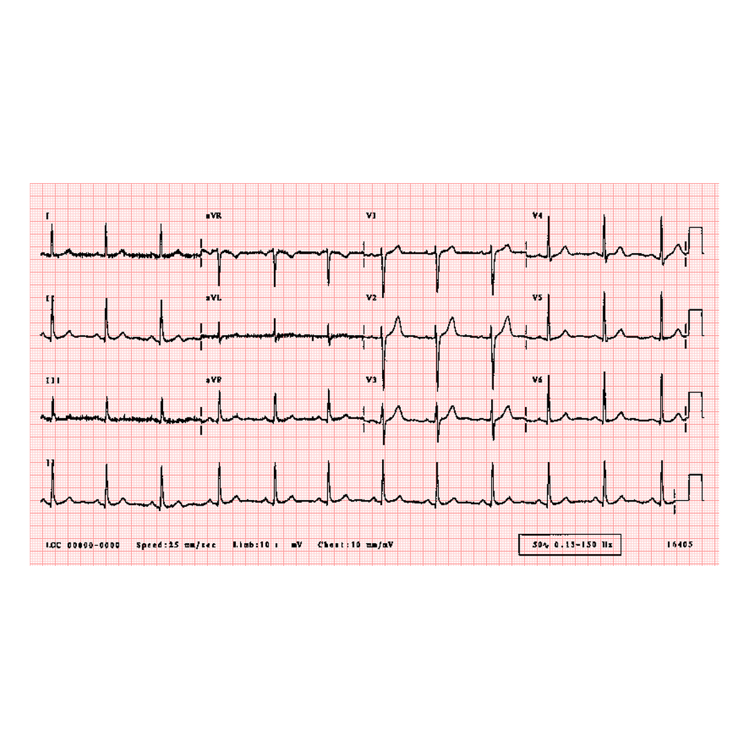 ECG Machine available in online  pharmacy qatar, doha 